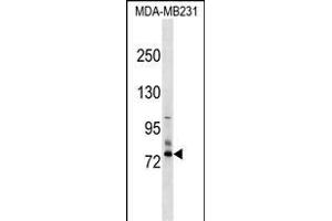 SCNN1D Antibody (N-term) (ABIN1539104 and ABIN2849251) western blot analysis in MDA-M cell line lysates (35 μg/lane).