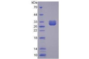 Image no. 1 for Chloride Channel Accessory 1 (CLCA1) (AA 416-670) (Active) protein (His tag) (ABIN6239825)