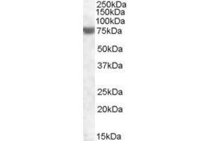 Image no. 1 for anti-Fem-1 Homolog A (FEM1A) (C-Term) antibody (ABIN570909)