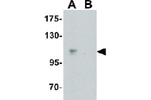 Image no. 1 for anti-CASK Interacting Protein 2 (CASKIN2) (N-Term) antibody (ABIN6655449)