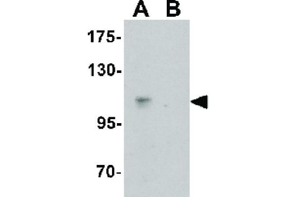 anti-CASK Interacting Protein 2 (CASKIN2) (N-Term) antibody