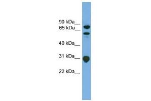 Image no. 1 for anti-SH3-Domain Kinase Binding Protein 1 (SH3KBP1) (N-Term) antibody (ABIN633146)