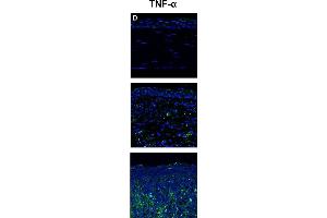 Immunohistochemistry (IHC) image for anti-Tumor Necrosis Factor alpha (TNF alpha) (AA 181-235) antibody (ABIN677318)