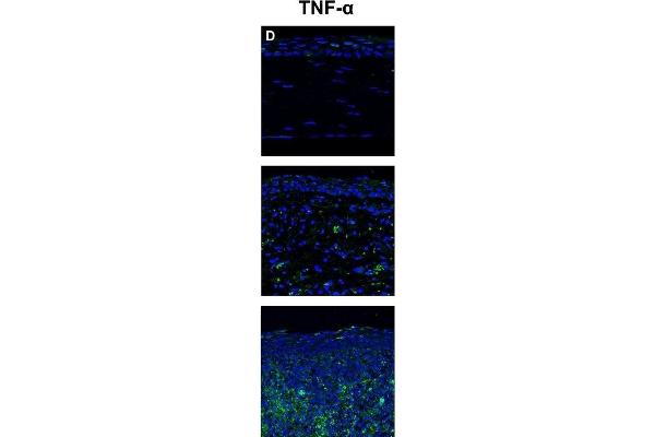 anti-Tumor Necrosis Factor alpha (TNF alpha) (AA 181-235) antibody