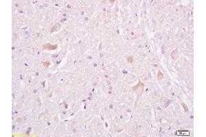 Image no. 3 for anti-Tuberous Sclerosis 2 (TSC2) (AA 1601-1750) antibody (ABIN701200)