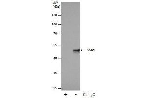 Image no. 2 for anti-Tripartite Motif Containing 21 (TRIM21) (Center) antibody (ABIN2856919)