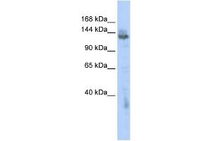 Image no. 1 for anti-Zinc Finger, MYND-Type Containing 8 (ZMYND8) (Middle Region) antibody (ABIN2776076)