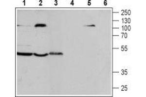 Western blot analysis of human T-cell leukemia Jurkat cell line (lanes 1 and 4), human acute lymphoblastic leukemia MOLT-4 (lanes 2 and 5) and mouse macrophage J774.