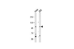 NEK4 antibody  (C-Term)
