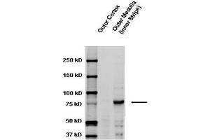 Image no. 2 for anti-Sodium Channel, Nonvoltage-Gated 1, gamma (SCNN1G) (AA 629-650) antibody (HRP) (ABIN2486429)