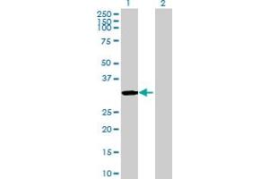anti-Solute Carrier Family 22, Member 24 (SLC22A24) (AA 1-322) antibody