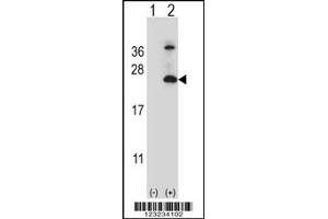 Image no. 2 for anti-Tetraspanin 6 (TSPAN6) (C-Term) antibody (ABIN2498046)