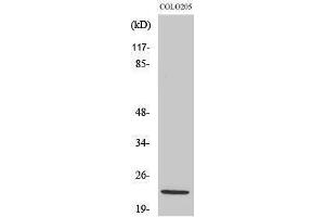 Image no. 1 for anti-NADH Dehydrogenase (Ubiquinone) 1 beta Subcomplex, 10, 22kDa (NDUFB10) (Internal Region) antibody (ABIN3185798)