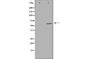 Image no. 1 for anti-Scavenger Receptor Class B, Member 1 (SCARB1) antibody (ABIN6264935)
