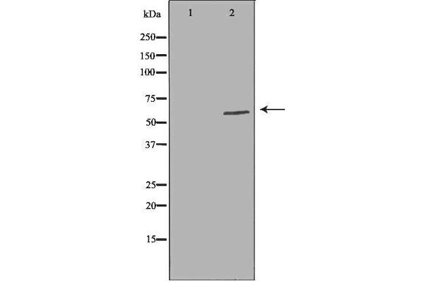 anti-Scavenger Receptor Class B, Member 1 (SCARB1) (Internal Region) antibody