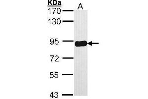 Image no. 2 for anti-Protein Kinase C Substrate 80K-H (PRKCSH) (Center) antibody (ABIN2855219)