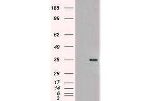 Image no. 3 for anti-Fibroblast Growth Factor 2 (Basic) (FGF2) (AA 10-155) antibody (ABIN1490786)