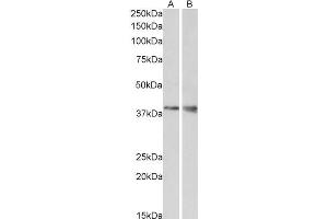 Image no. 1 for anti-Wingless-Type MMTV Integration Site Family, Member 9B (WNT9B) (Internal Region) antibody (ABIN571005)