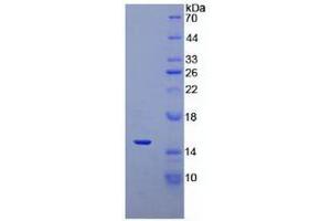 Image no. 1 for Defensin, alpha 5, Paneth Cell-Specific (DEFA5) protein (ABIN3009135)