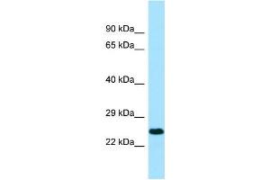Image no. 1 for anti-Killer Cell Immunoglobulin-Like Receptor, Two Domains, Long Cytoplasmic Tail, 3 (KIR2DL3) (Middle Region) antibody (ABIN2790295)