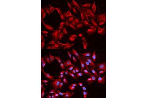 Image no. 1 for anti-BCL2-Like 13 (Apoptosis Facilitator) (BCL2L13) antibody (ABIN1512626)