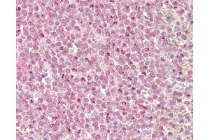 Image no. 2 for anti-Myeloid/lymphoid Or Mixed-Lineage Leukemia 2 (MLL2) (AA 2-14) antibody (ABIN1494780)