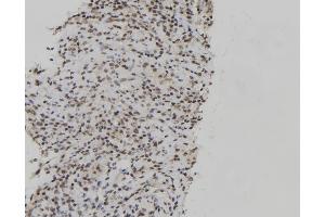 Image no. 1 for anti-Jun B Proto-Oncogene (JUNB) (pThr102), (pThr104) antibody (ABIN6256461)