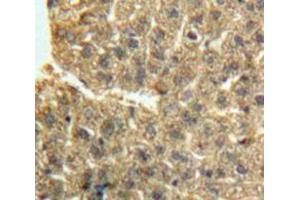 Image no. 2 for anti-Growth Differentiation Factor 2 (GDF2) (AA 241-418) antibody (ABIN1858986)