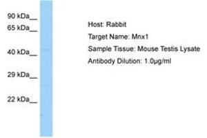 Image no. 1 for anti-Motor Neuron and Pancreas Homeobox 1 (MNX1) (AA 251-300) antibody (ABIN6749823)