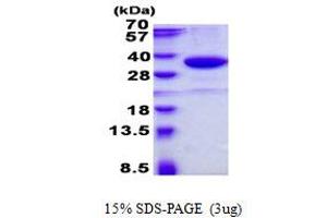 Image no. 1 for Single-Strand-Selective Monofunctional Uracil-DNA Glycosylase 1 (SMUG1) protein (His tag) (ABIN1098479)
