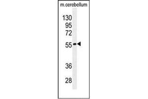 Image no. 2 for anti-Family with Sequence Similarity 69, Member B (FAM69B) (AA 114-144), (N-Term) antibody (ABIN952241)