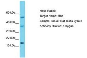 Image no. 1 for anti-Orexin (OX) (AA 45-94) antibody (ABIN6750422)