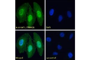 Image no. 4 for anti-Tripartite Motif Containing 28 (TRIM28) (C-Term) antibody (ABIN184913)