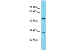 Image no. 1 for anti-Tyrosyl-tRNA Synthetase 2, Mitochondrial (YARS2) (Middle Region) antibody (ABIN2790889)