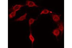 Image no. 3 for anti-Cell Division Cycle 37 Homolog (S. Cerevisiae) (CDC37) (pSer13) antibody (ABIN6256126)