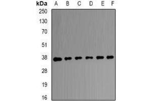 Image no. 2 for anti-Transaldolase 1 (TALDO1) (full length) antibody (ABIN6005462)