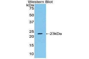 anti-RAD54-Like 2 (RAD54L2) (AA 638-837) antibody