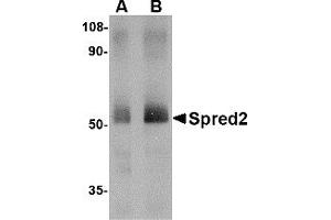 Western Blotting (WB) image for anti-Sprouty-Related, EVH1 Domain Containing 2 (SPRED2) (Middle Region) antibody (ABIN1031103)