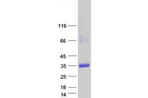 Image no. 1 for Crystallin, lambda 1 (CRYL1) protein (Myc-DYKDDDDK Tag) (ABIN2724472)