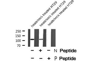 Image no. 1 for anti-Inner Centromere Protein Antigens 135/155kDa (INCENP) (pThr59) antibody (ABIN6272120)