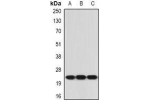 Image no. 3 for anti-Interleukin 21 (IL21) (full length) antibody (ABIN6043590)