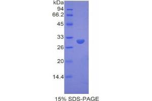 Image no. 1 for Dystrophin (DMD) protein (ABIN3009210)