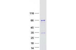 Image no. 1 for Transcription Factor 3 (E2A Immunoglobulin Enhancer Binding Factors E12/E47) (TCF3) (Transcript Variant 2) protein (Myc-DYKDDDDK Tag) (ABIN2733358)