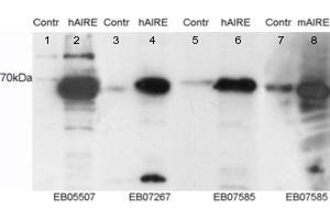 Image no. 1 for anti-Autoimmune Regulator (AIRE) (C-Term) antibody (ABIN184780)
