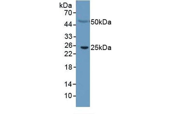C-Reactive Protein (CRP) ELISA Kit