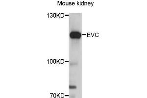 Image no. 1 for anti-Ellis Van Creveld Syndrome (EVC) antibody (ABIN6290358)