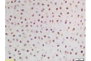 anti-Zinc Finger Protein 268 (ZNF268) (AA 151-250) antibody