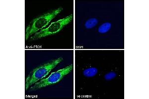 Image no. 5 for anti-Patched 1 (PTCH1) (C-Term) antibody (ABIN185521)