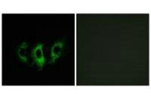 Immunofluorescence analysis of A549 cells, using GFM2 antibody.
