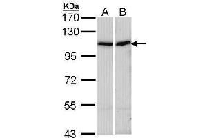 Image no. 2 for anti-Actinin, alpha 4 (ACTN4) (Internal Region) antibody (ABIN2856884)